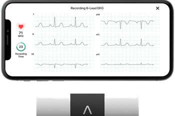 KardiaMobile 6 Lead Personal EKG Monitor